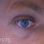 eyeice73