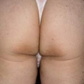 noani