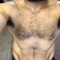 fregio535953