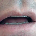 lucafree