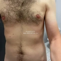 Prometeo22