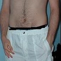 marco981