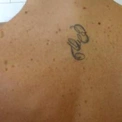 senza1complicazioni