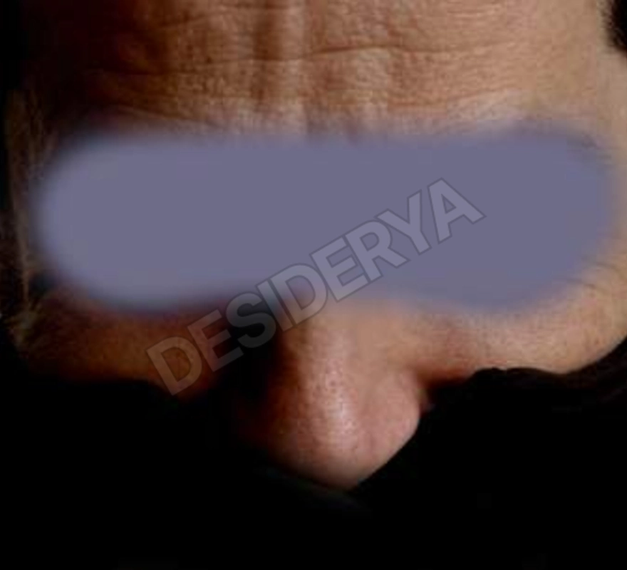 senzazucchero5535605