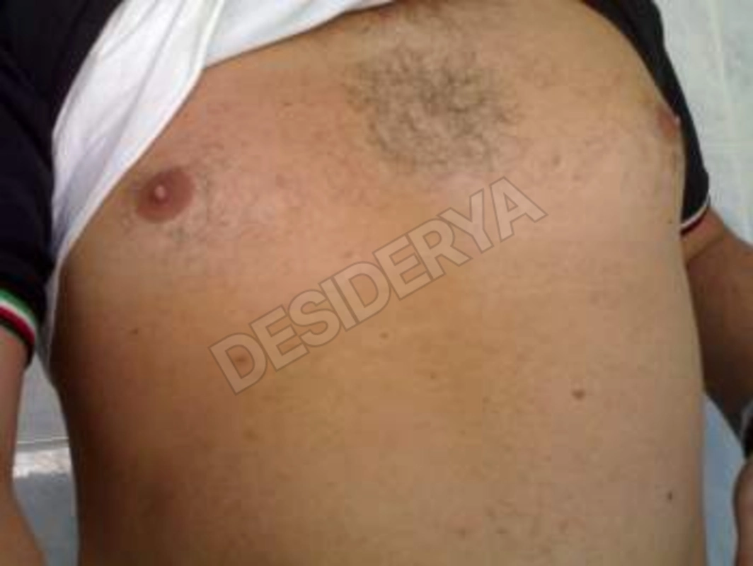 bsxpr5582532