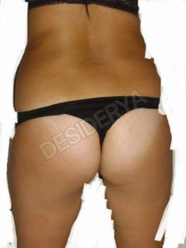 coppiaerosx5592444