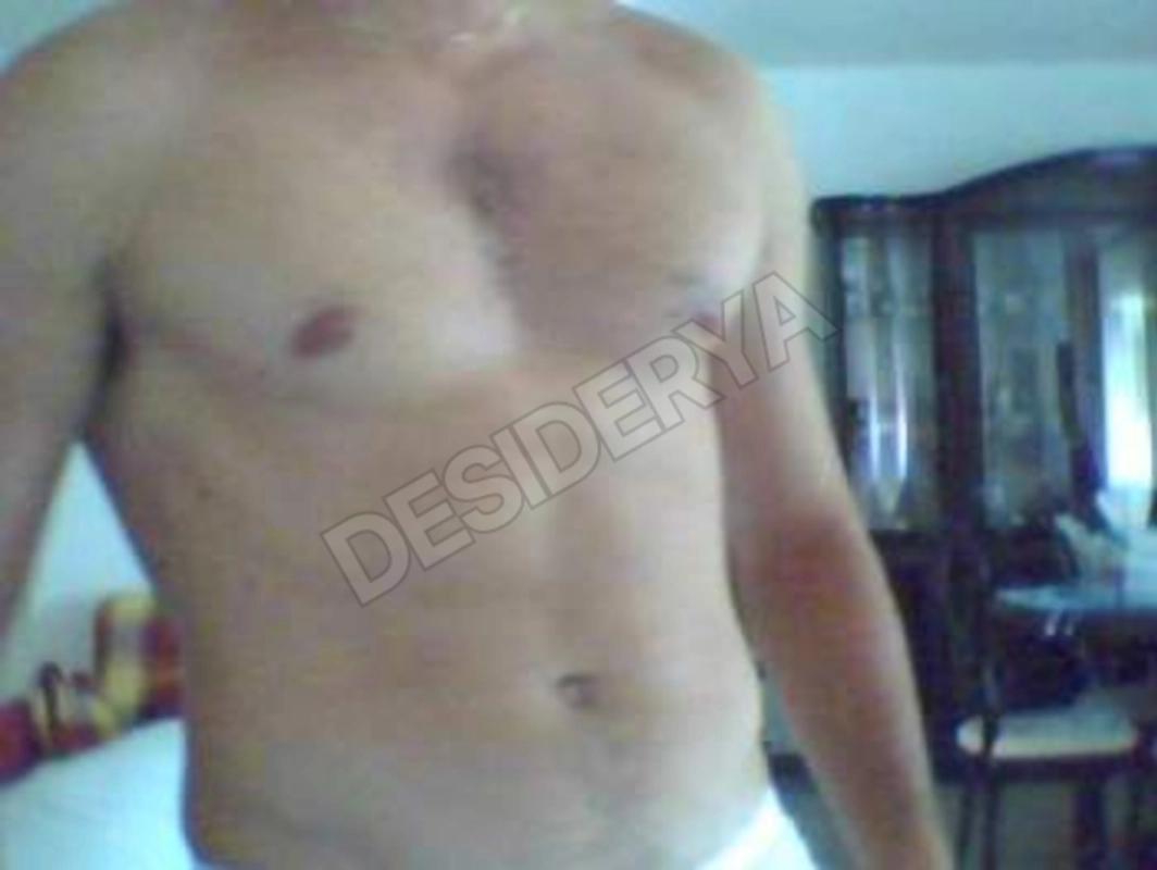 pataccone5293762