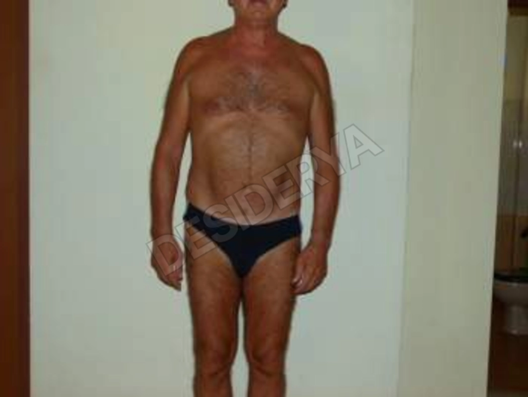 valerio69415527380