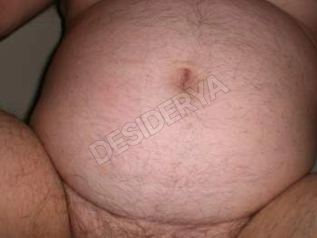 passivo605311624