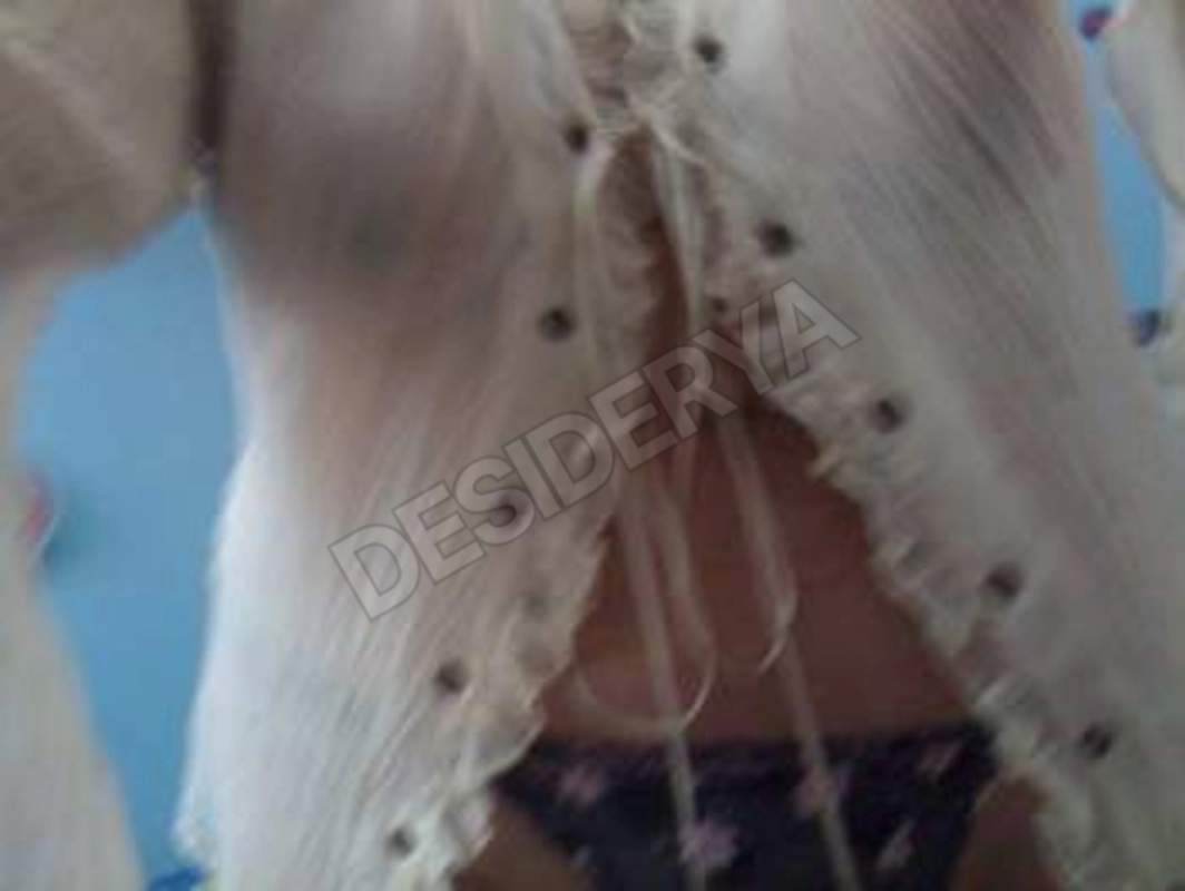 cpcs20125694489