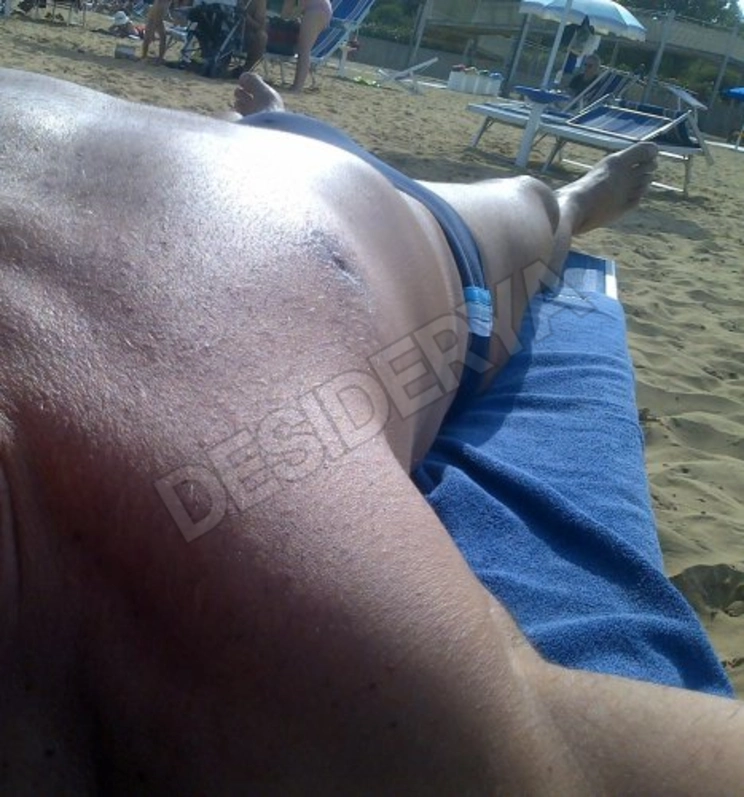 argentocaldo4593532