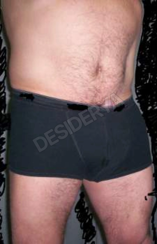 astichegioca5529648