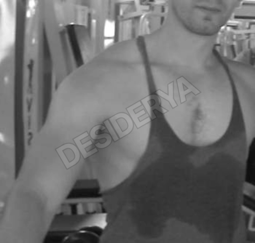 Coppiax285519439