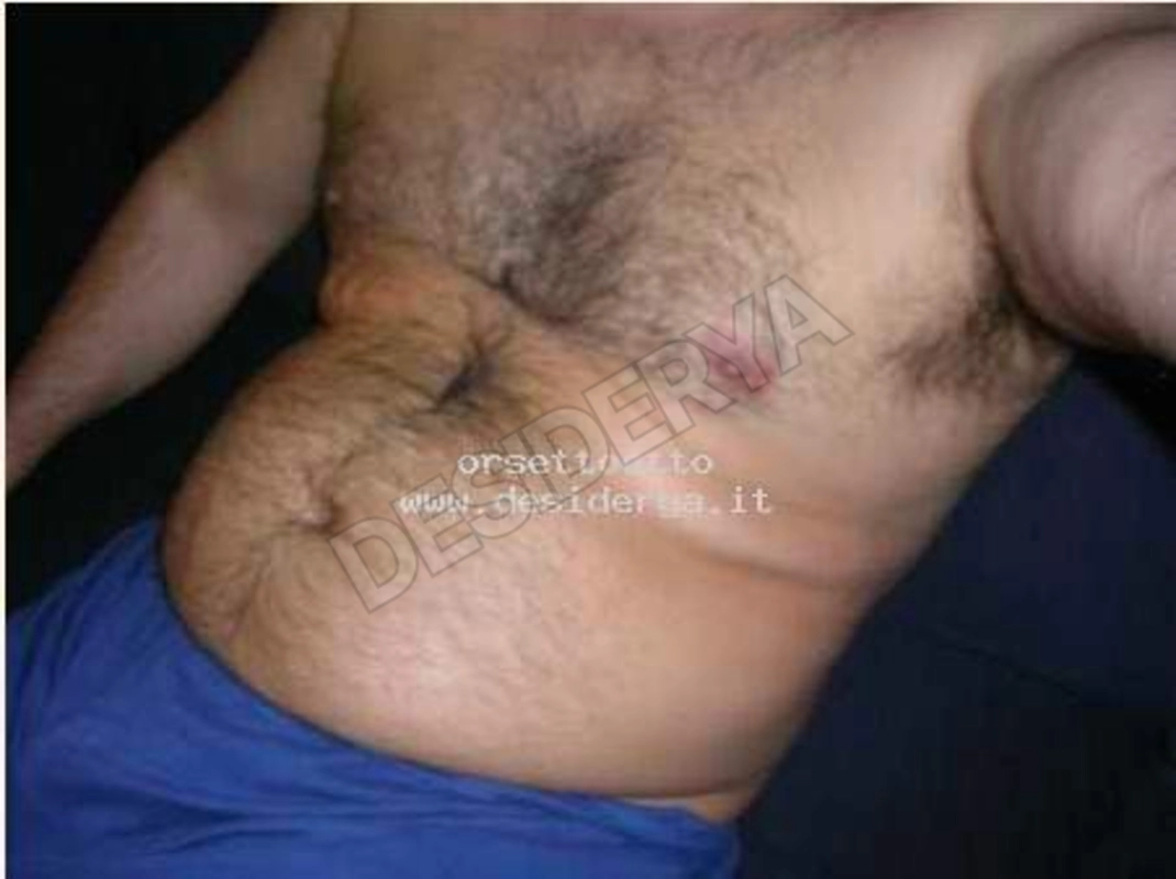 orsettoetto5876873