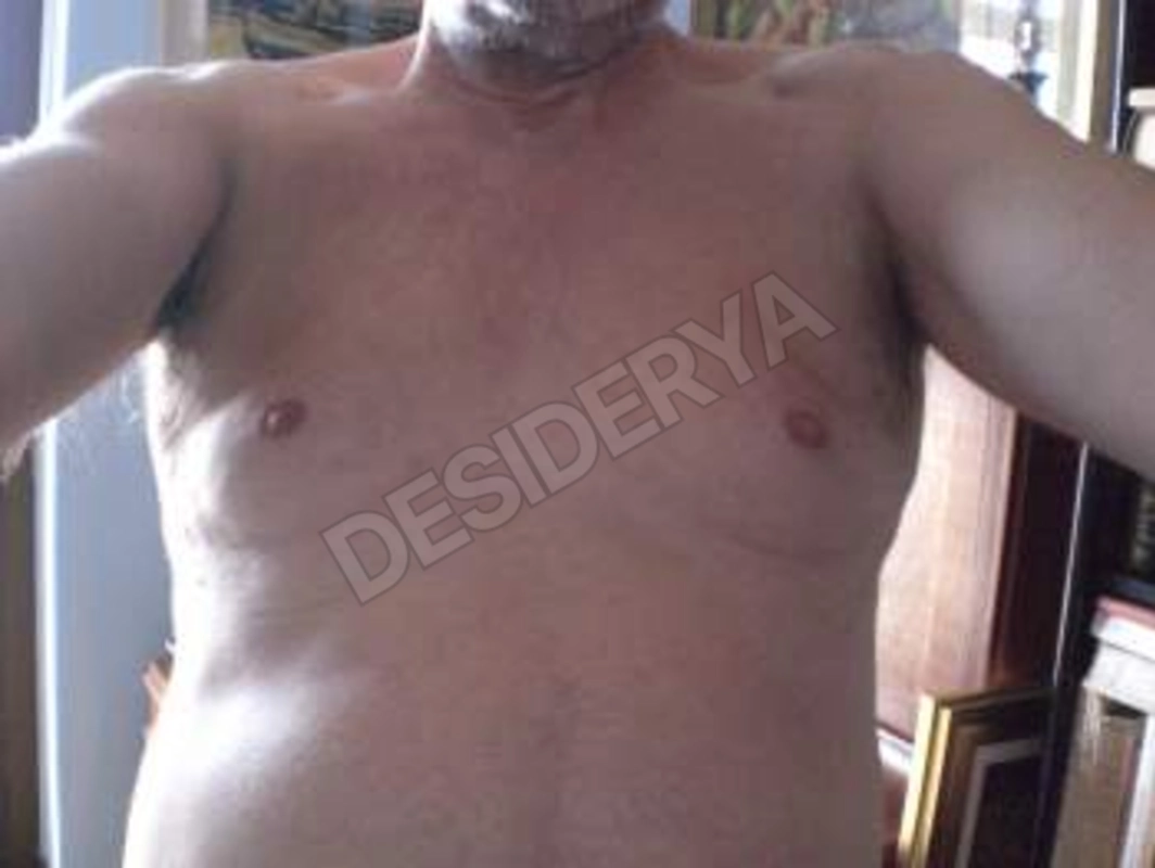 passivo605311626