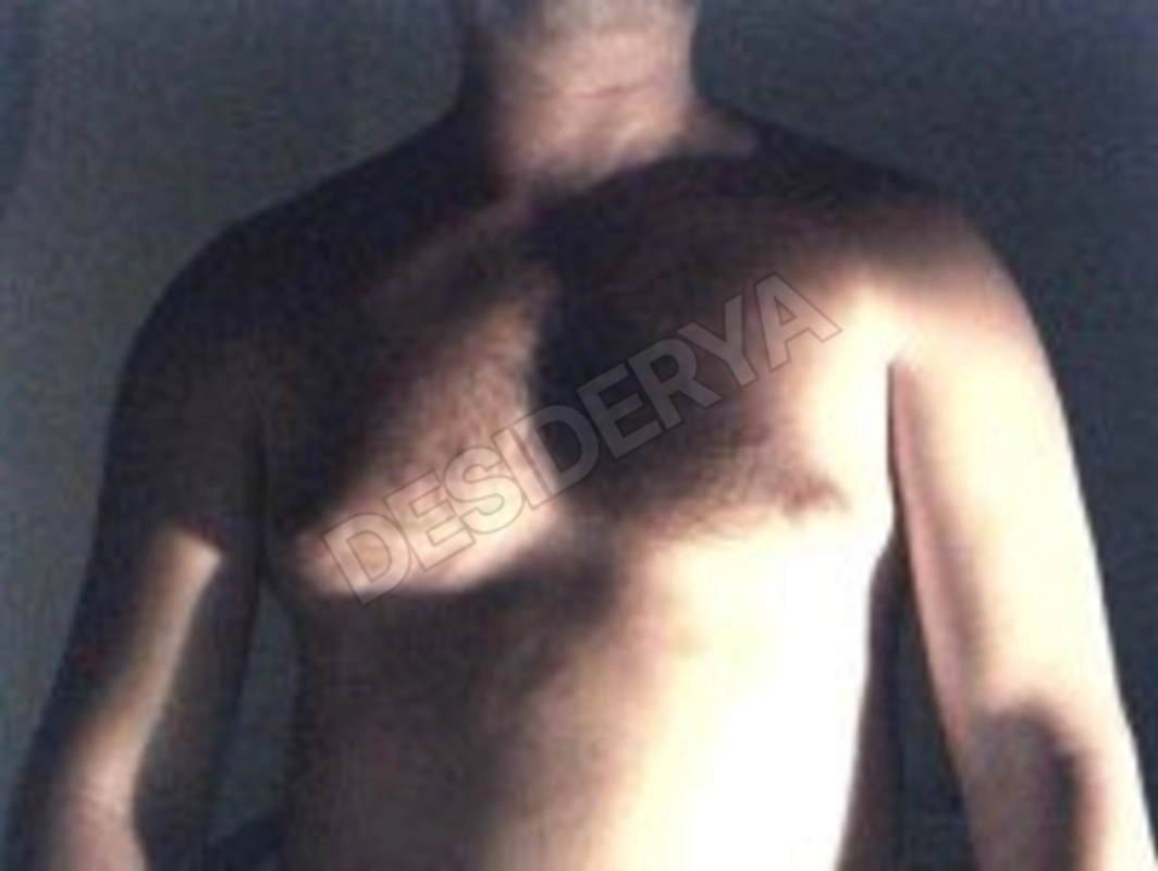 erosiltoro5328961
