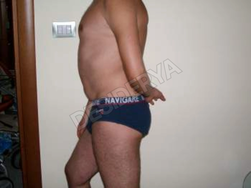 siculoarrapato5578885