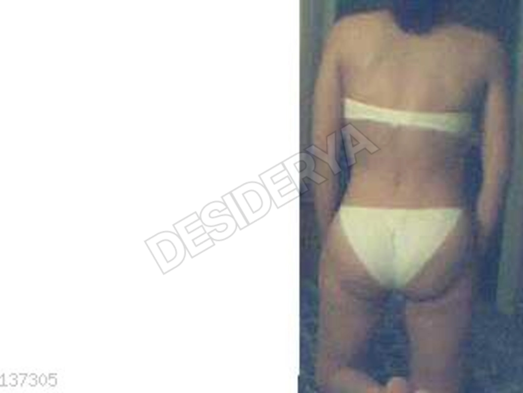 Saturniana5363127