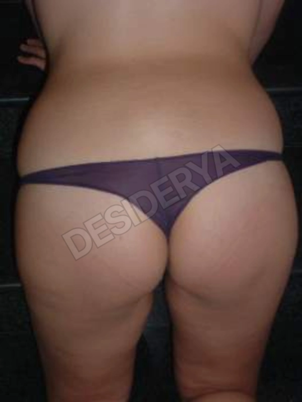 Lesbia30Catullo5312746