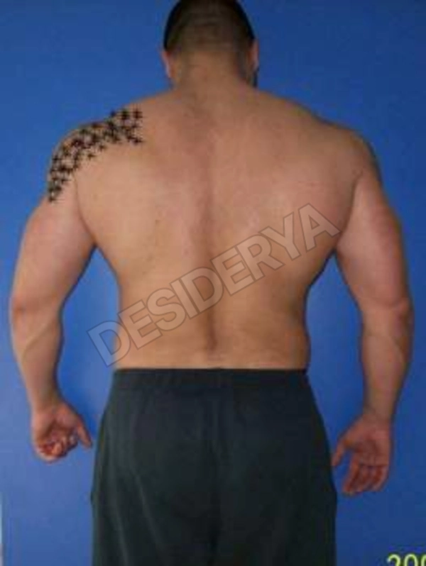 porxello285331135