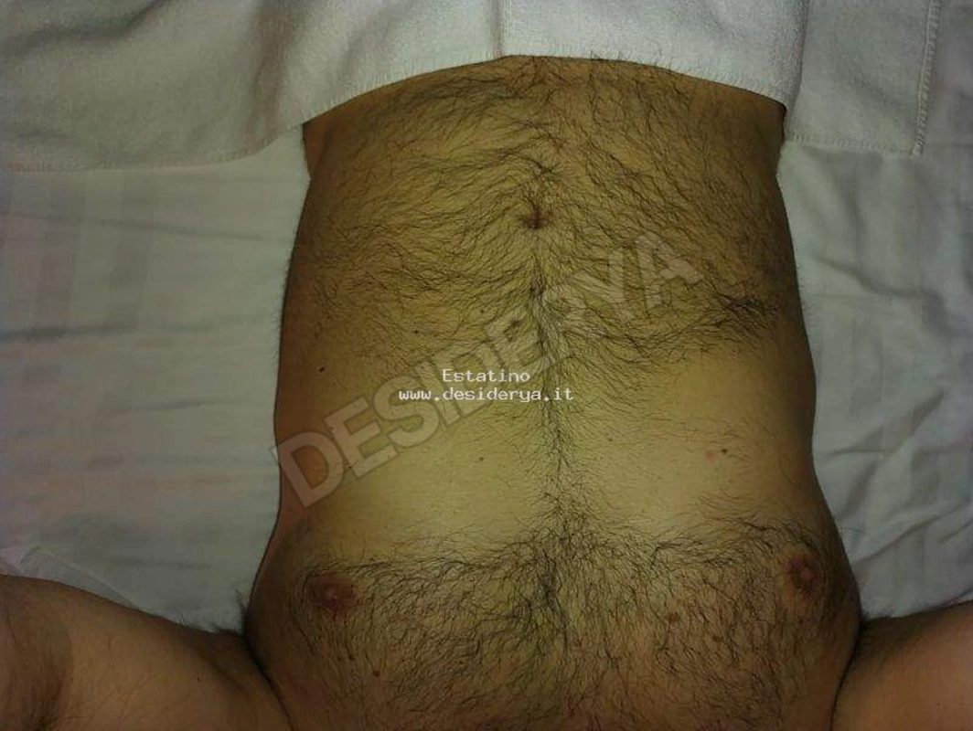 Estatino5861469