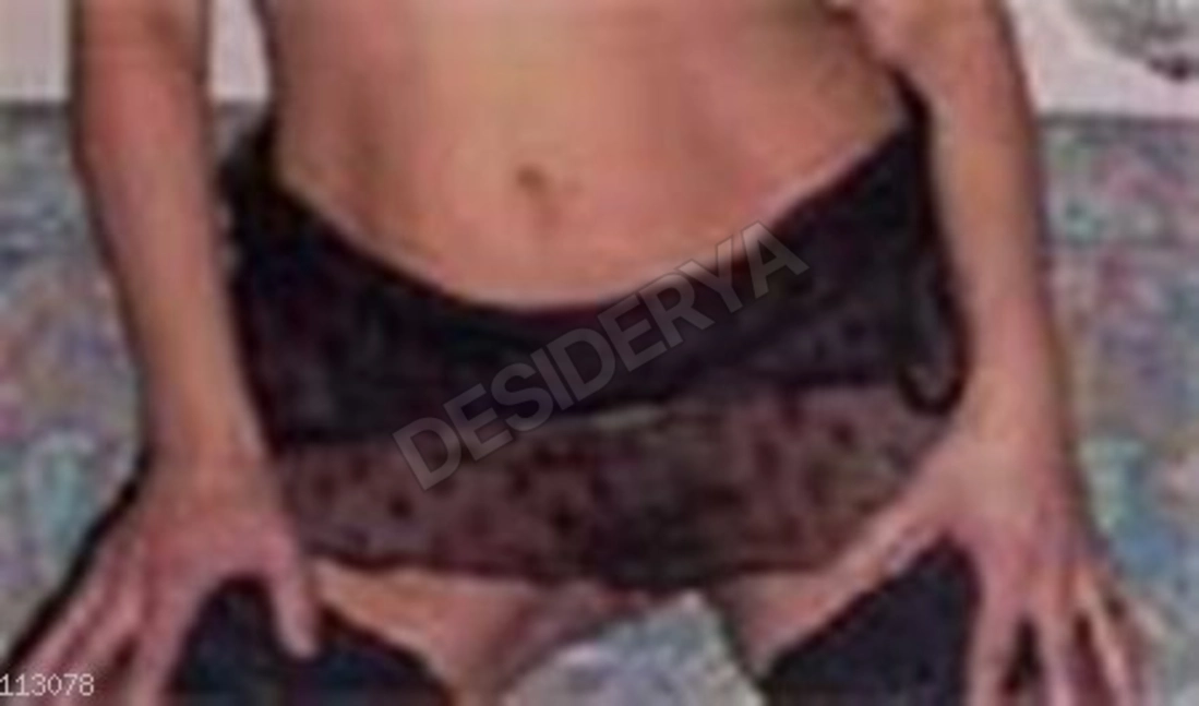 Bella1CoppiaCS5347756