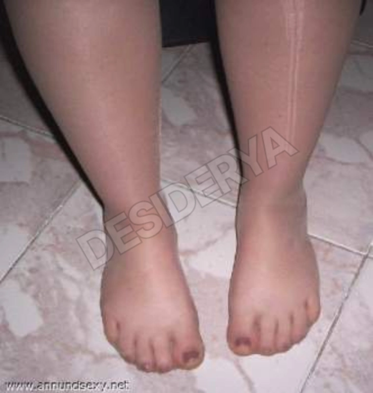 suoyo995526681