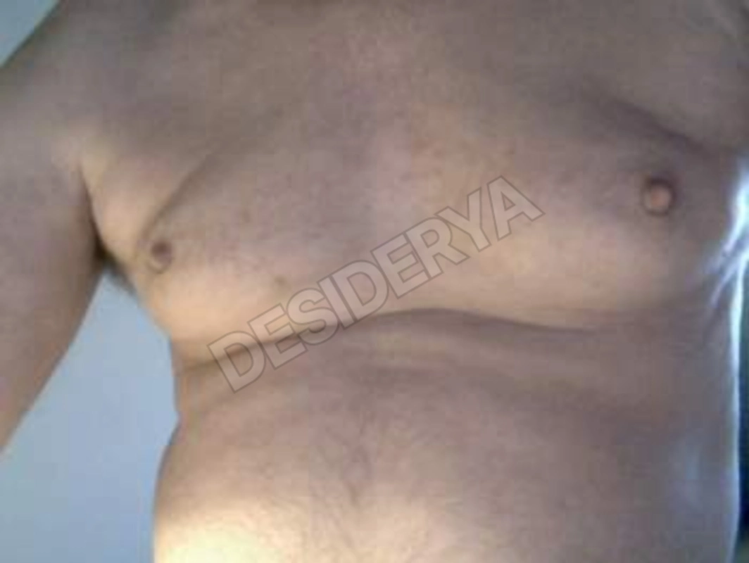 passivo605311625