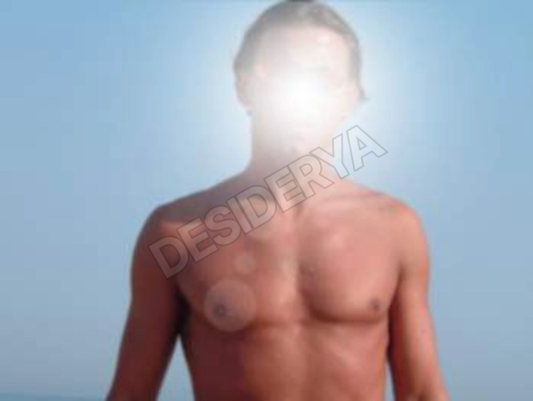 hot1eros5591525
