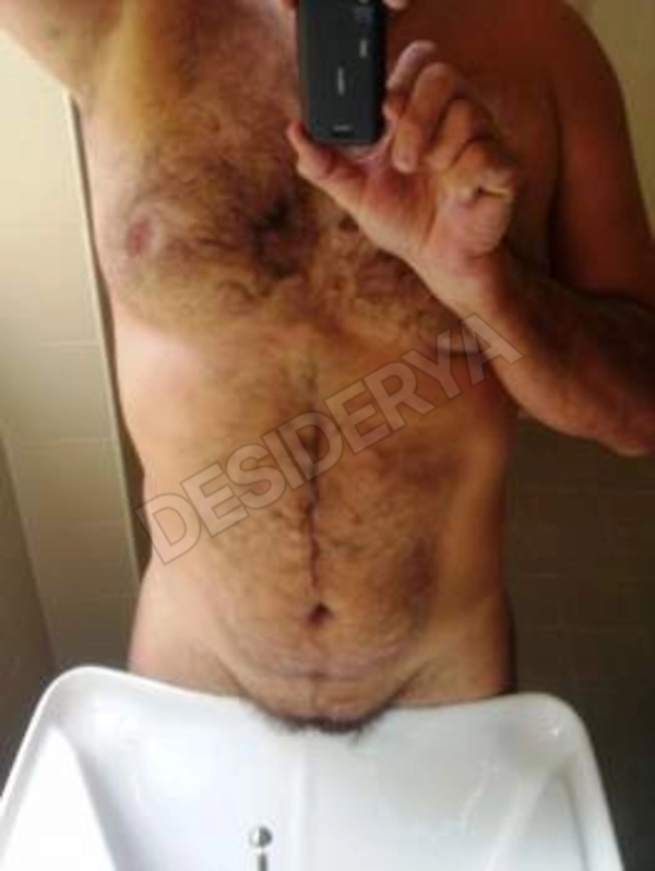 apertamente665582112