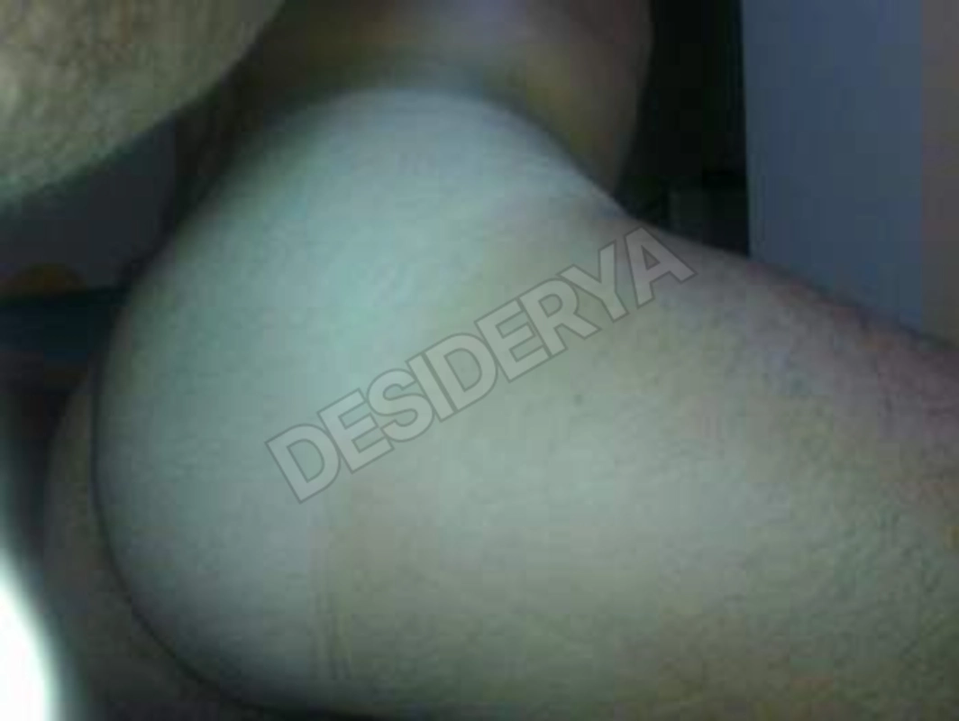 Toro7445560943