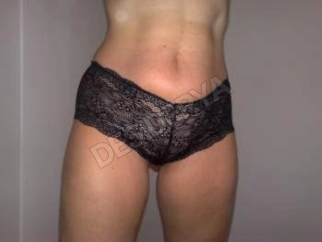 adt335274108
