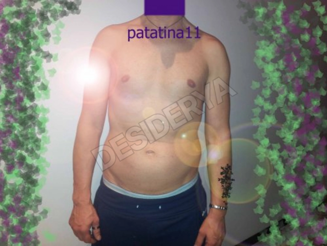 patatina114659904