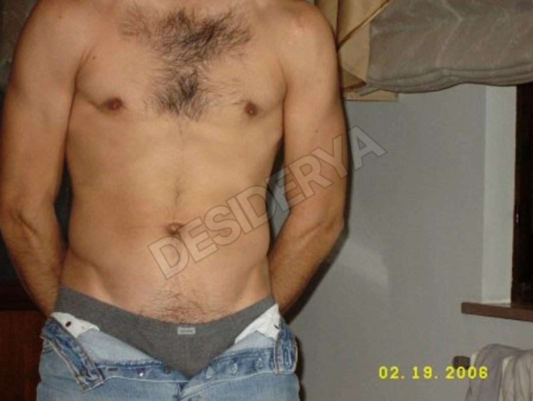 belmoro155306049