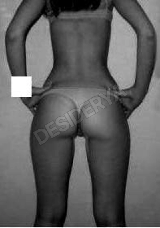 morettabsx5606200