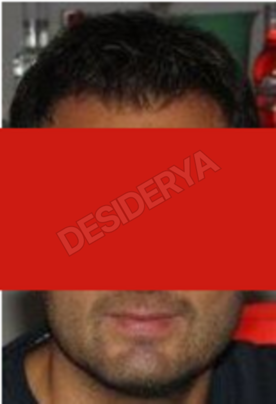 mico764947647