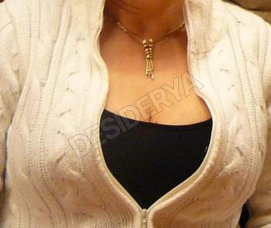 Antobigtit5544026