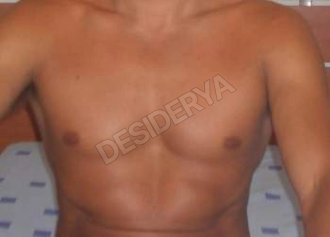 FRANCALLEN5589321