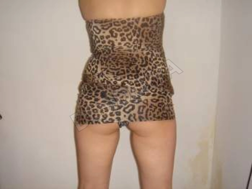 i1pazi5574210
