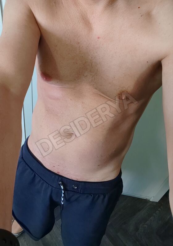 Single405201472