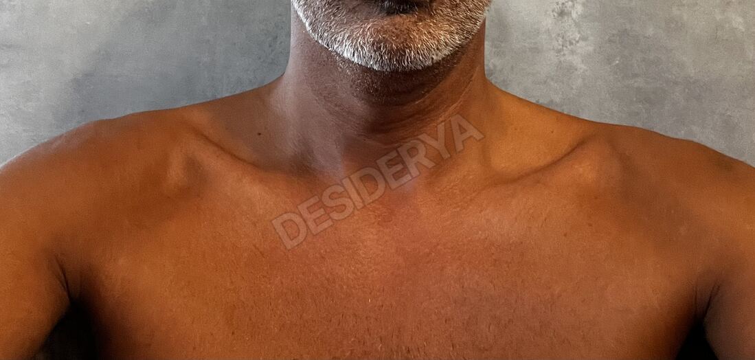 FaSe255954983