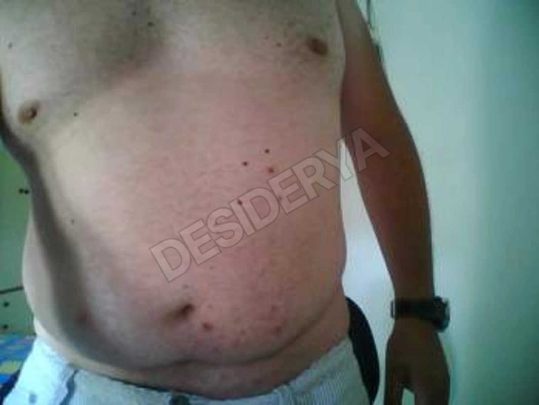 diomede25373687