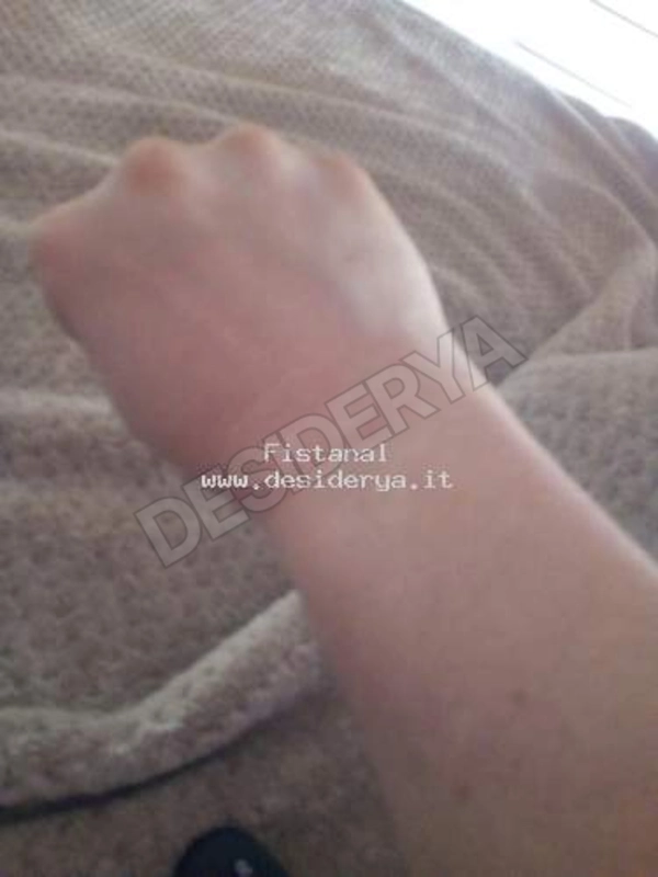 Fistanal5832903