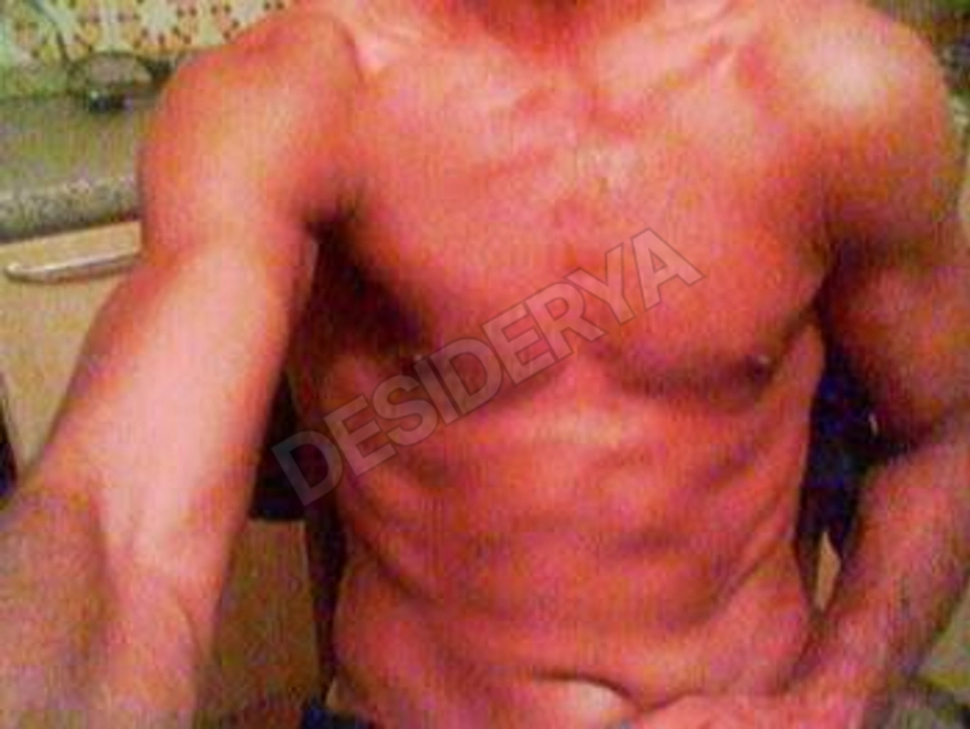 er3mitico5580739