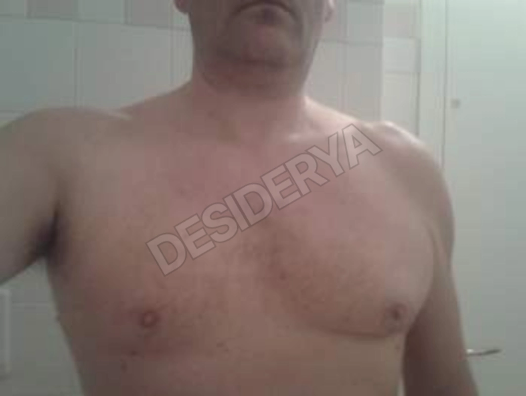 aliasbsx5313847