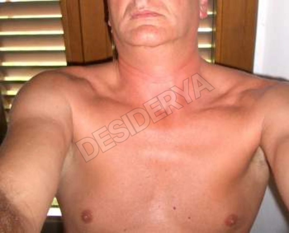 Albey5564244