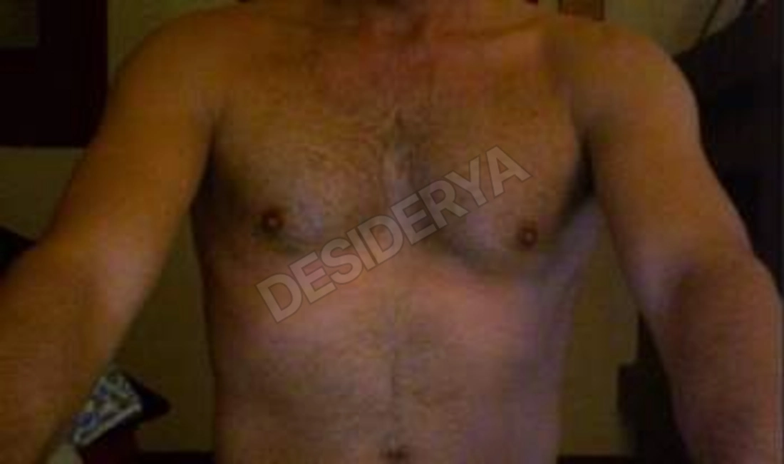 rojo775556744