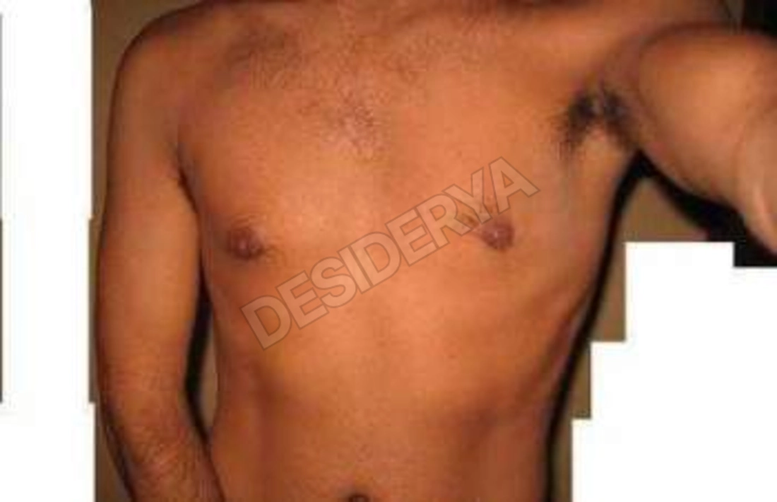moltogrosso765540768