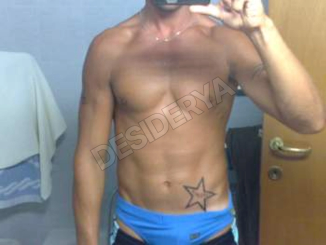 Nicomcxxx5366642