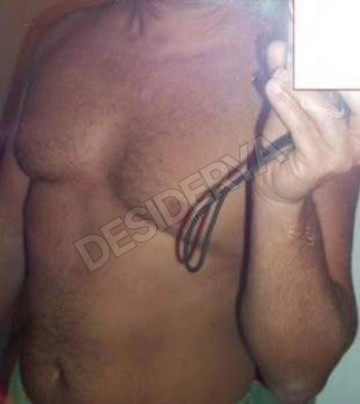 nmarco5365949